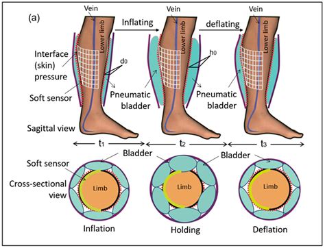 sensation testing for intermittent pneumatic compression|Effect of intermittent pneumatic compression with different .